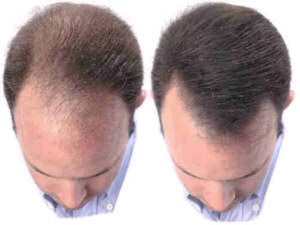 BeforeAndAfterMittel300